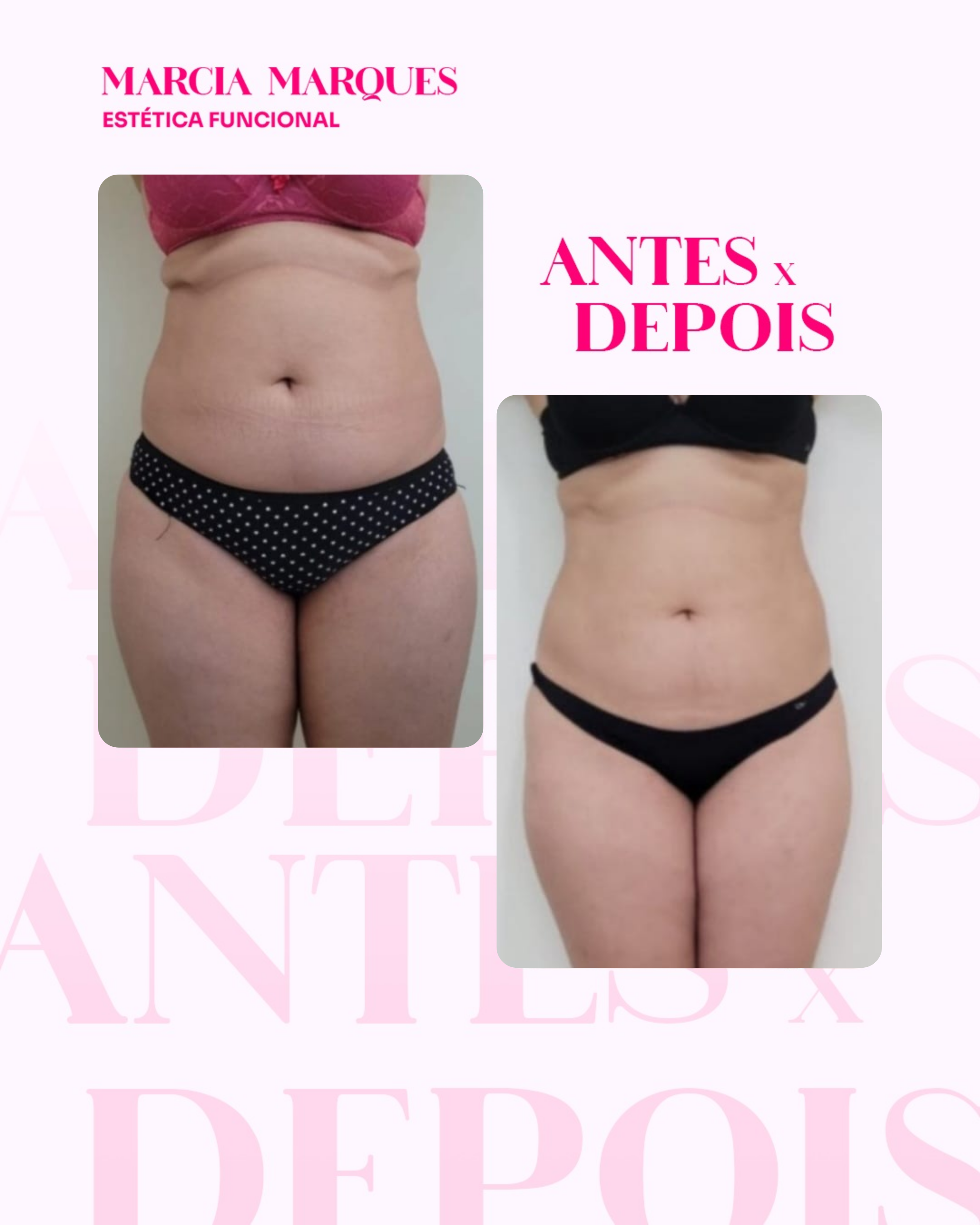 Antes e Depois 6